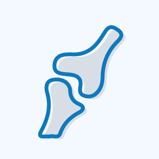 Joint Replacement